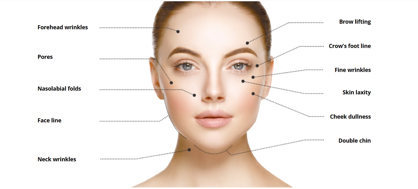 HIFU Treatment in Lucknow